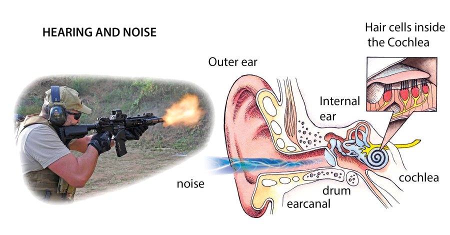 Hearing protection Hearing protection